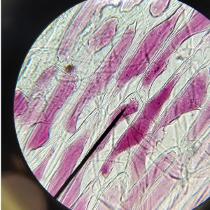 Plasmolysierte Zelle des Zwiebelhäutchens